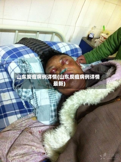 山东炭疽病例详情(山东炭疽病例详情最新)-第2张图片