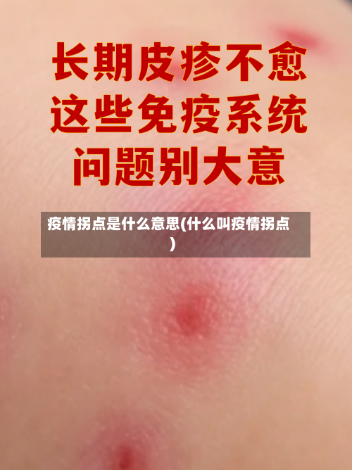 疫情拐点是什么意思(什么叫疫情拐点)
